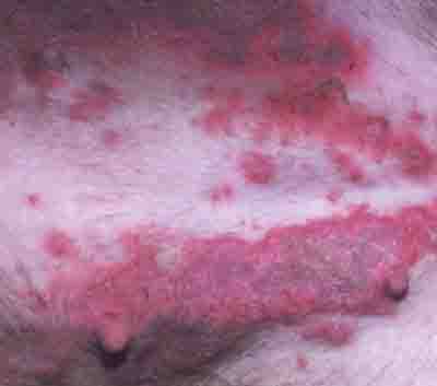 Treating Labrador Retriever Skin Problems